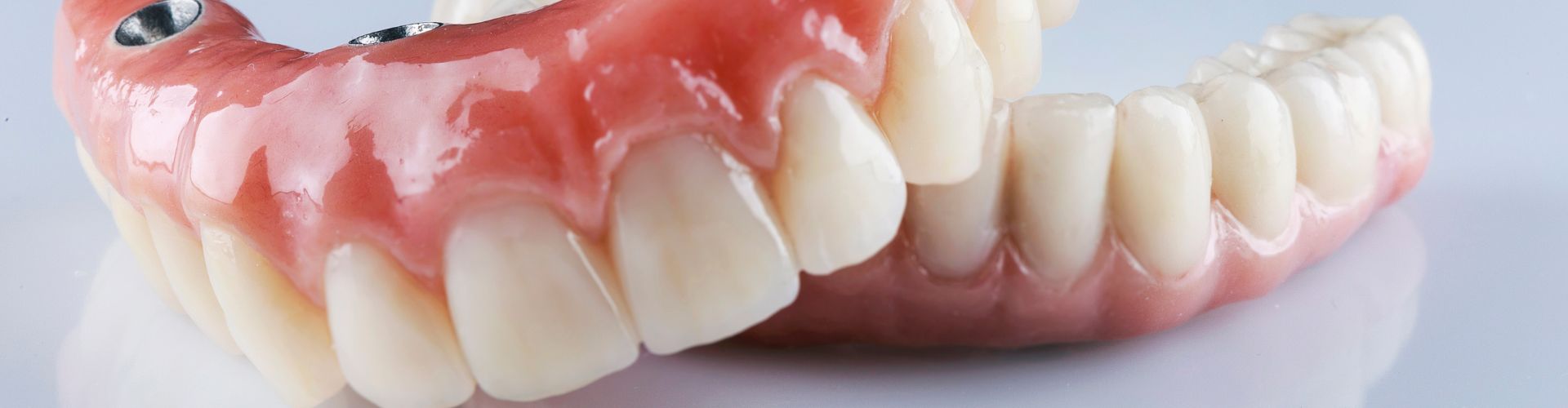 Consejos para pacientes con prótesis dentales