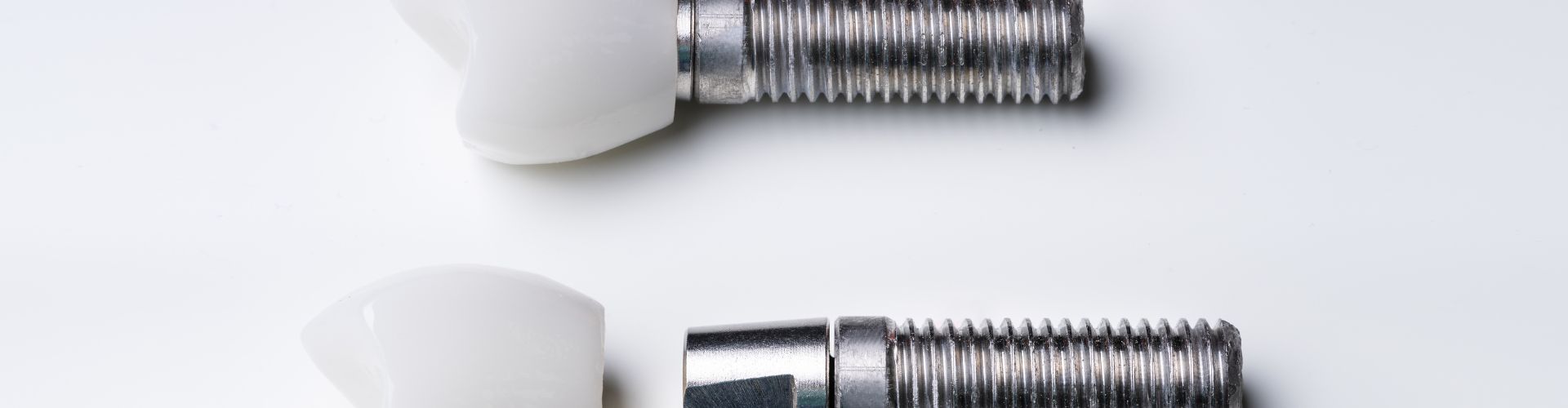 rechazos de los implantes dentales