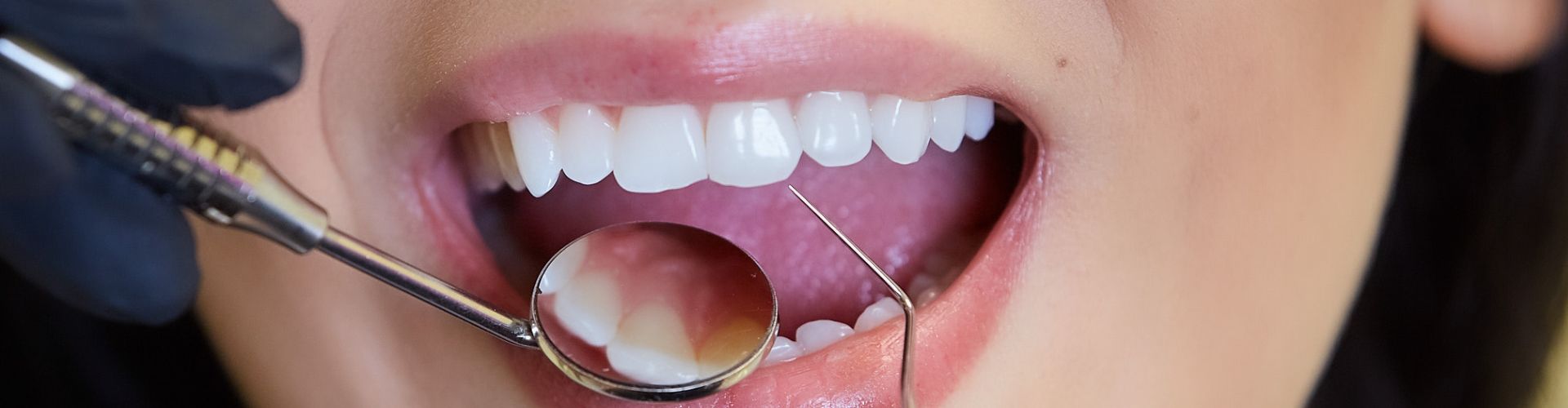 traumatismos dentales