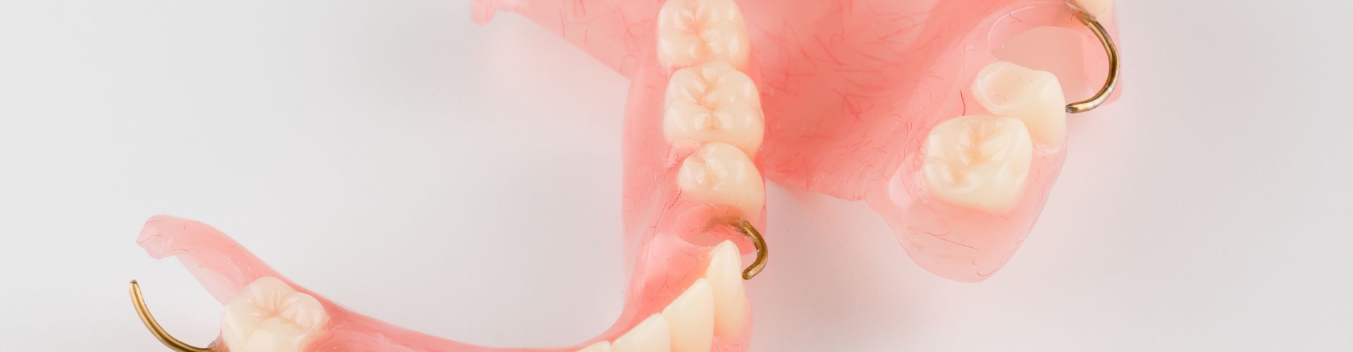 qué son las prótesis dentales