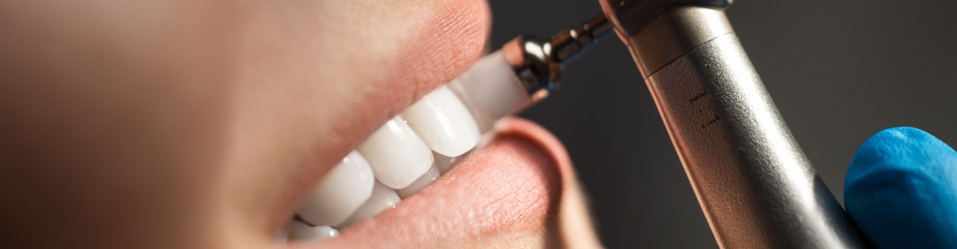 precio de una limpieza dental