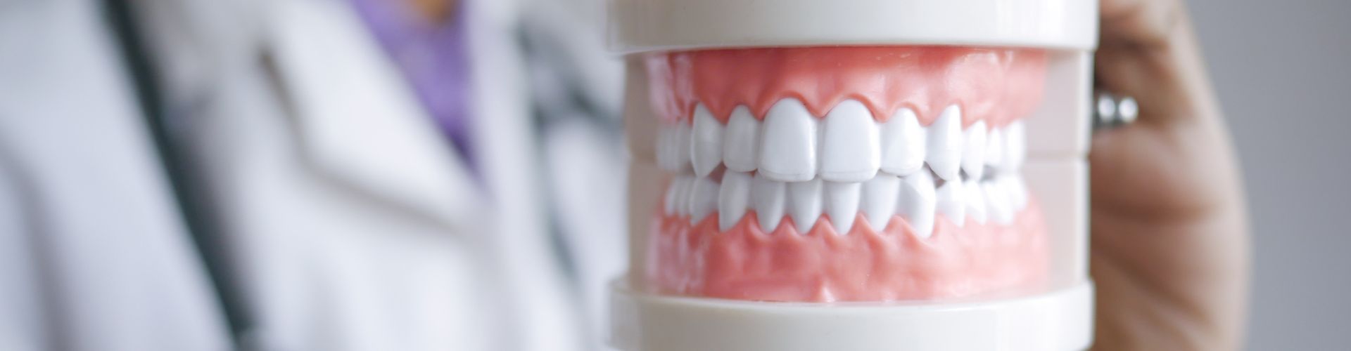 dentadura fija sobre 4 implantes