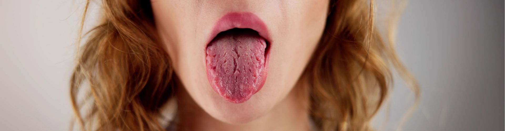 grietas en la lengua