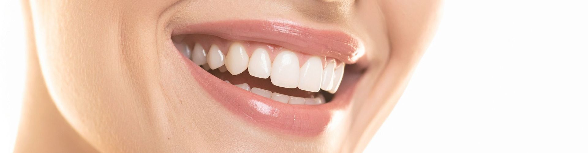 Cuánto puede durar los resultados de un blanqueamiento dental