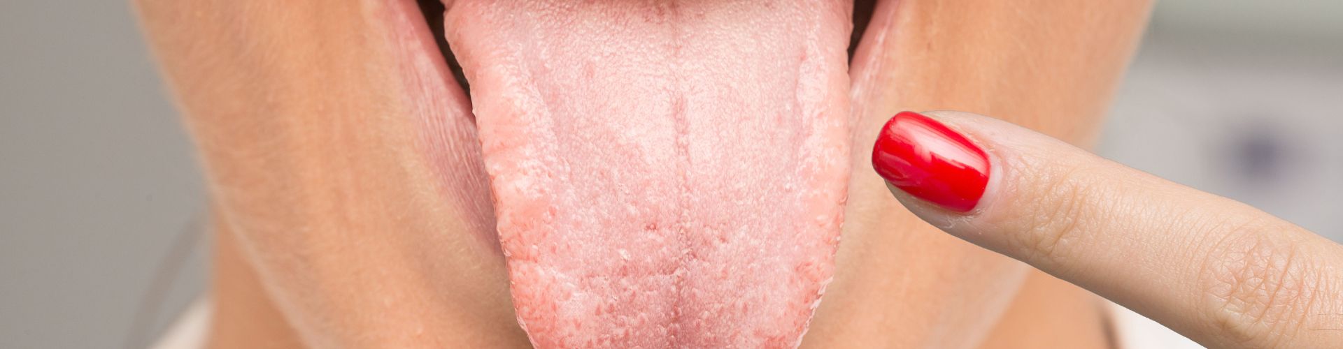 lengua saburral