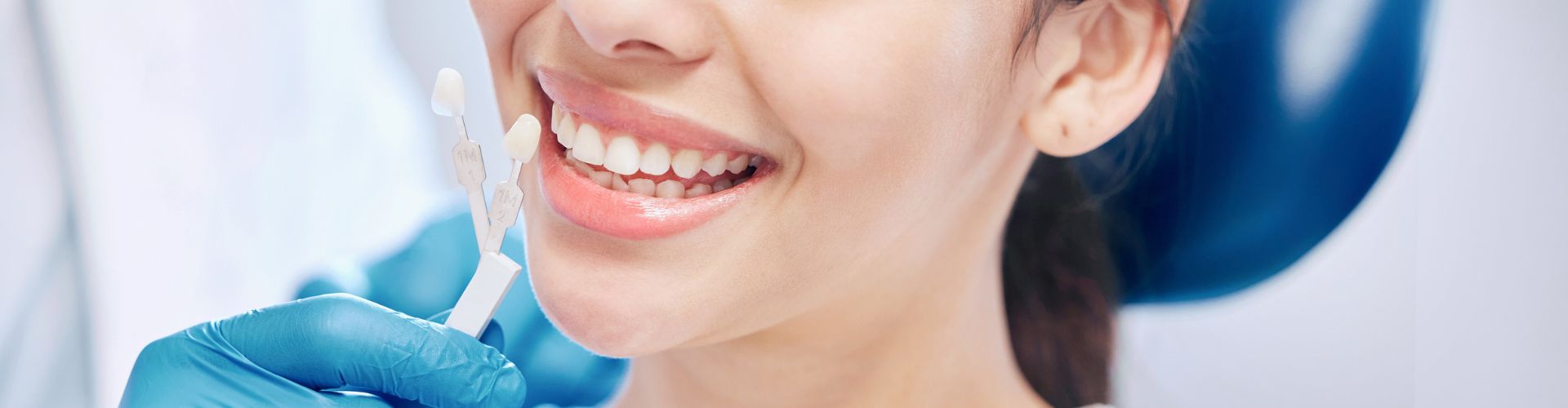 mantenimiento carillas dentales