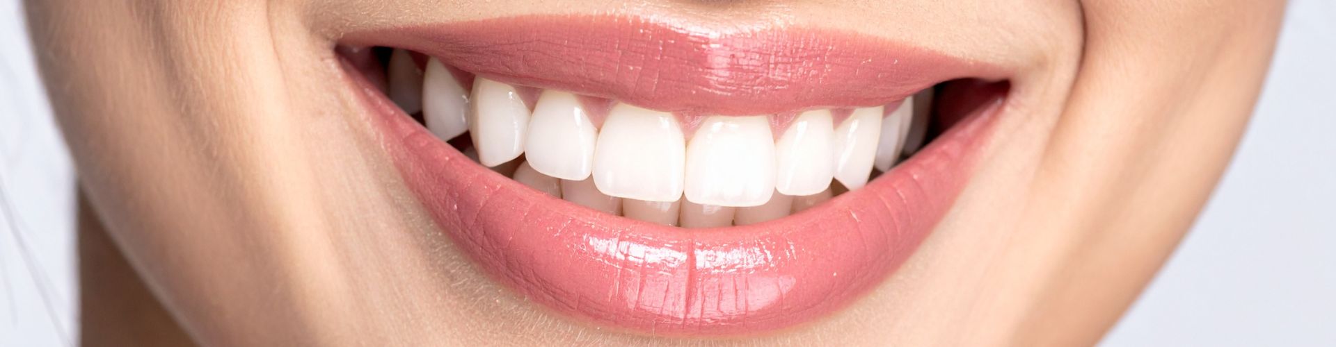 cuidados durante y tras blanqueamiento dental